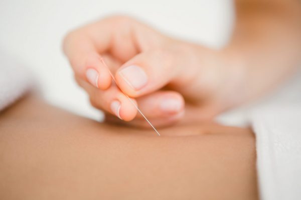 Akupunktur/TCM